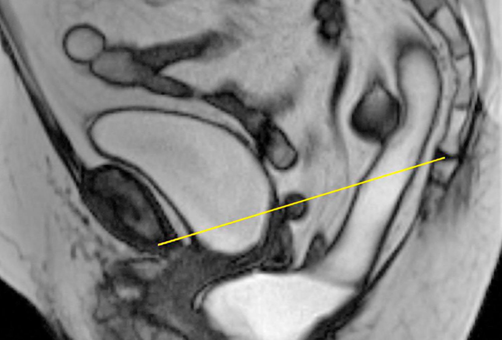 DIAKO_Radiologie-Beckenboden