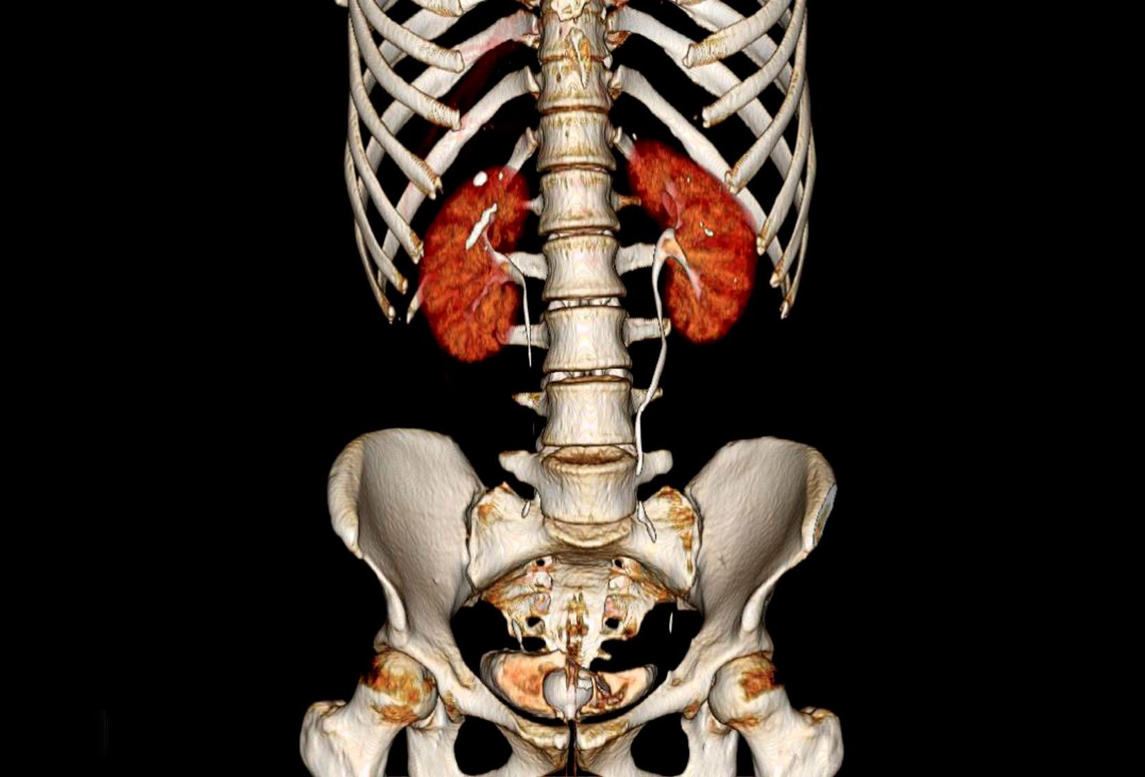 Urogenital_Niere_VRT