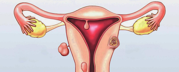 Fotolia_43653739_Myom