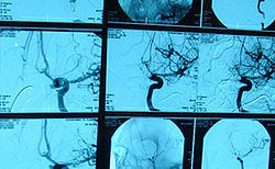 Teaser_Neurochirurgie_5