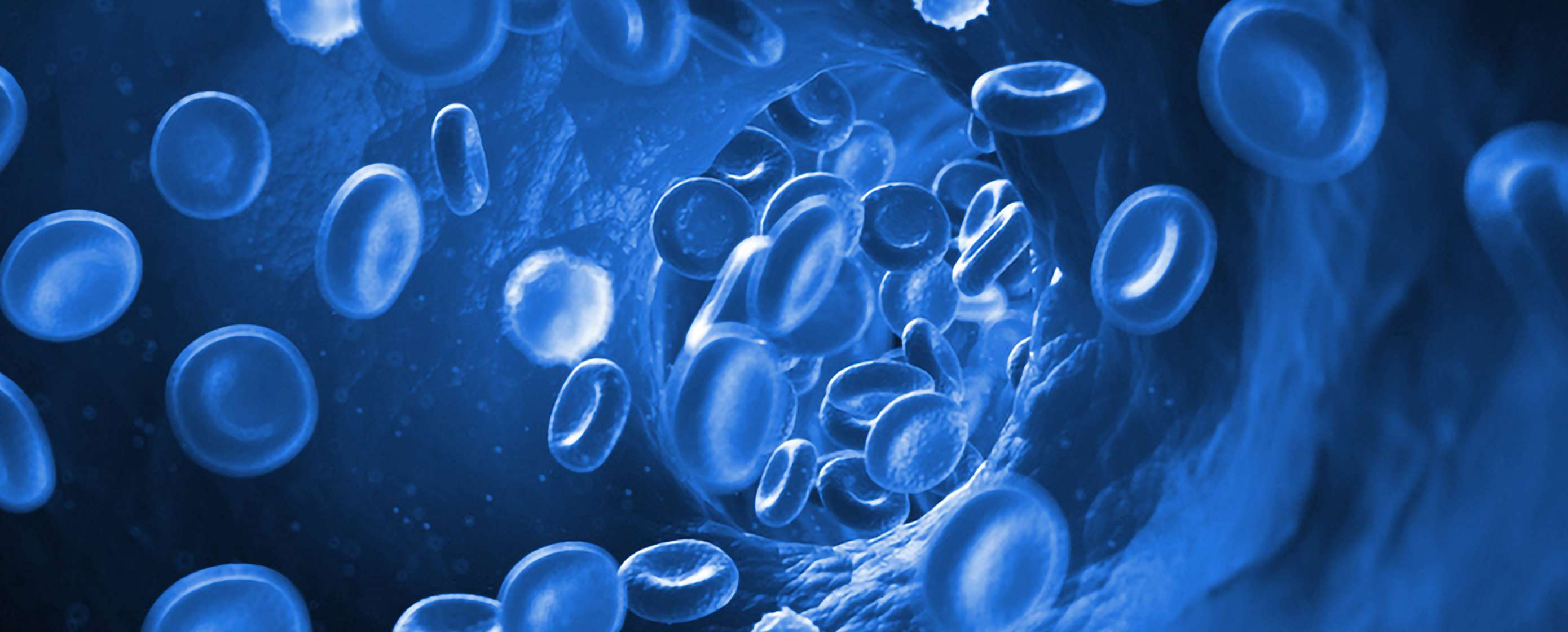 Fotolia_50962189_arteriosklerosis