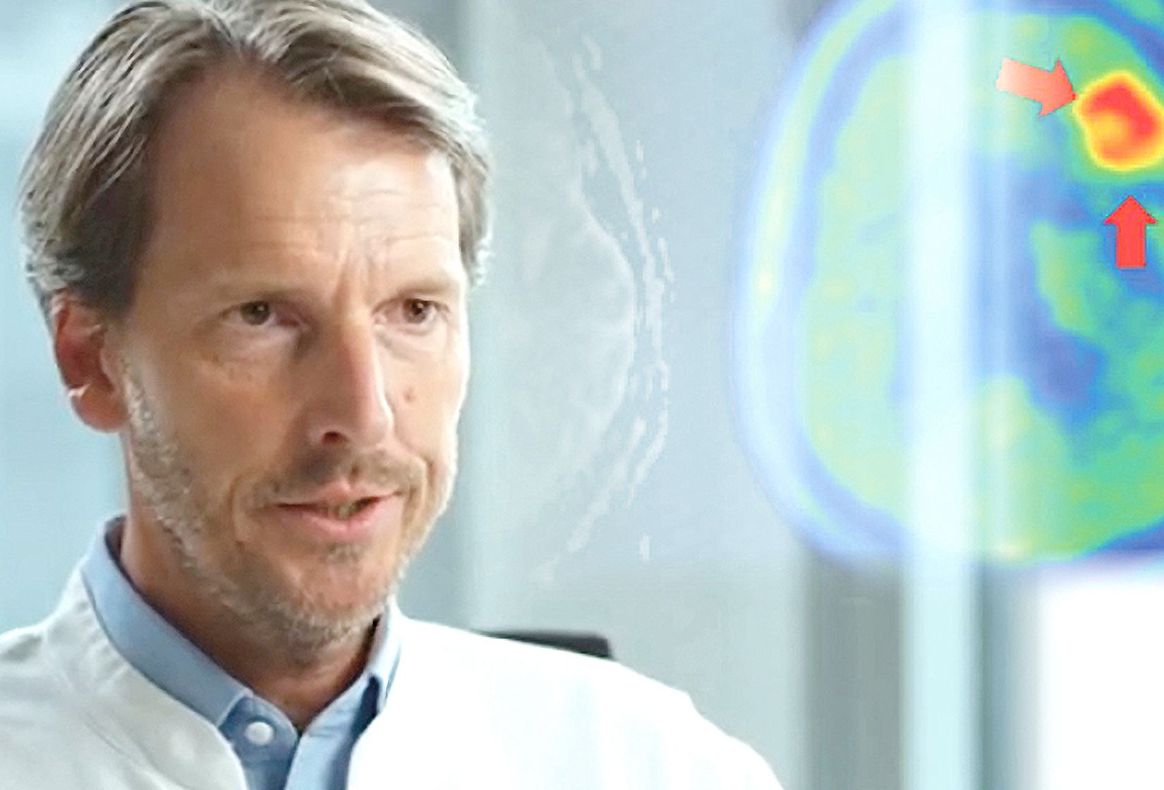 2021_11_Hirnmetastasen-NC-Regelsberger_web