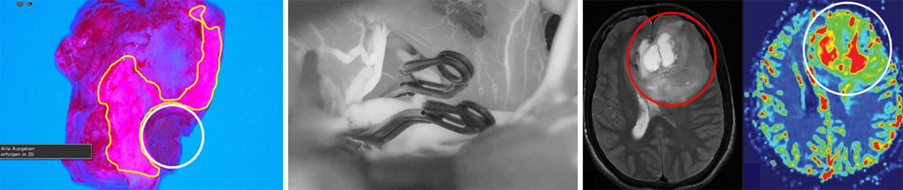 intro-neurochirurgie-diako