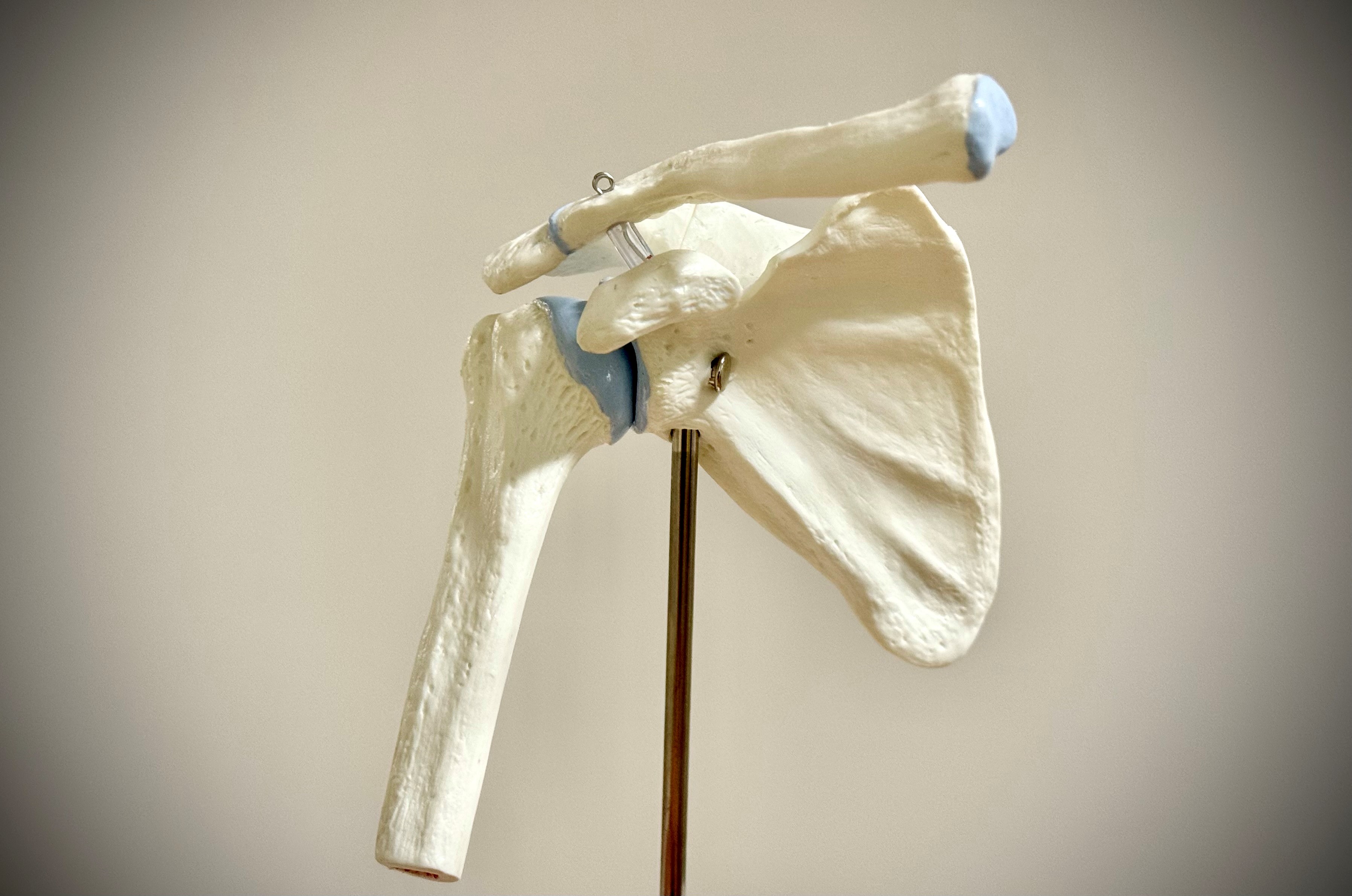 Schulterendoprothese